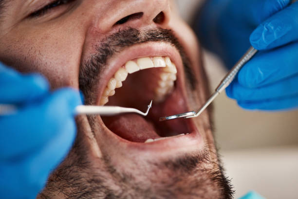 Best Urgent Care for Lost Fillings or Crowns in Hurley, WI
